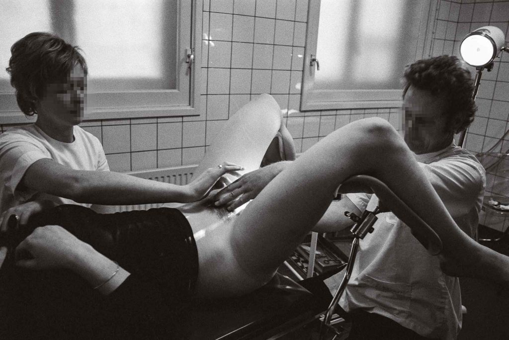 En mars 1974, à la clinique Sarfati à Amsterdam, le Dr Nieborer, assisté d’une représentante française du Mlac, procède à un avortement. API / GAMMA RAPHO